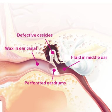 ear_canal_01